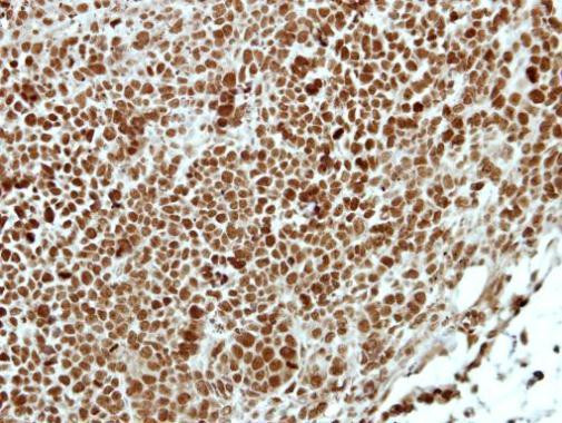 APPL1 Antibody in Immunohistochemistry (Paraffin) (IHC (P))