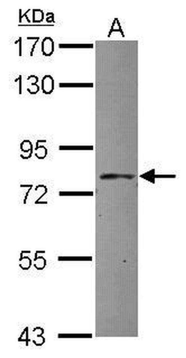 APPL1 Antibody in Western Blot (WB)