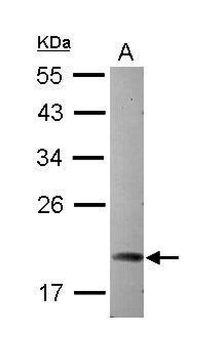 ARL5A Antibody in Western Blot (WB)