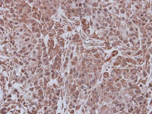 FBXL4 Antibody in Immunohistochemistry (Paraffin) (IHC (P))