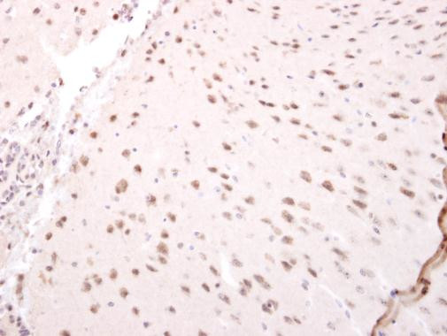 NARF Antibody in Immunohistochemistry (Paraffin) (IHC (P))