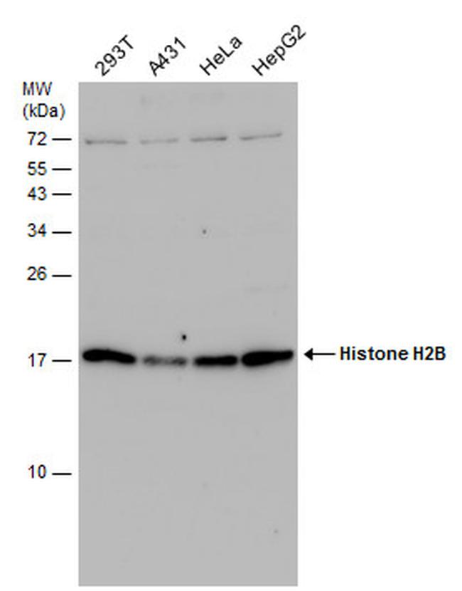 HIST1H2BD Antibody in Western Blot (WB)
