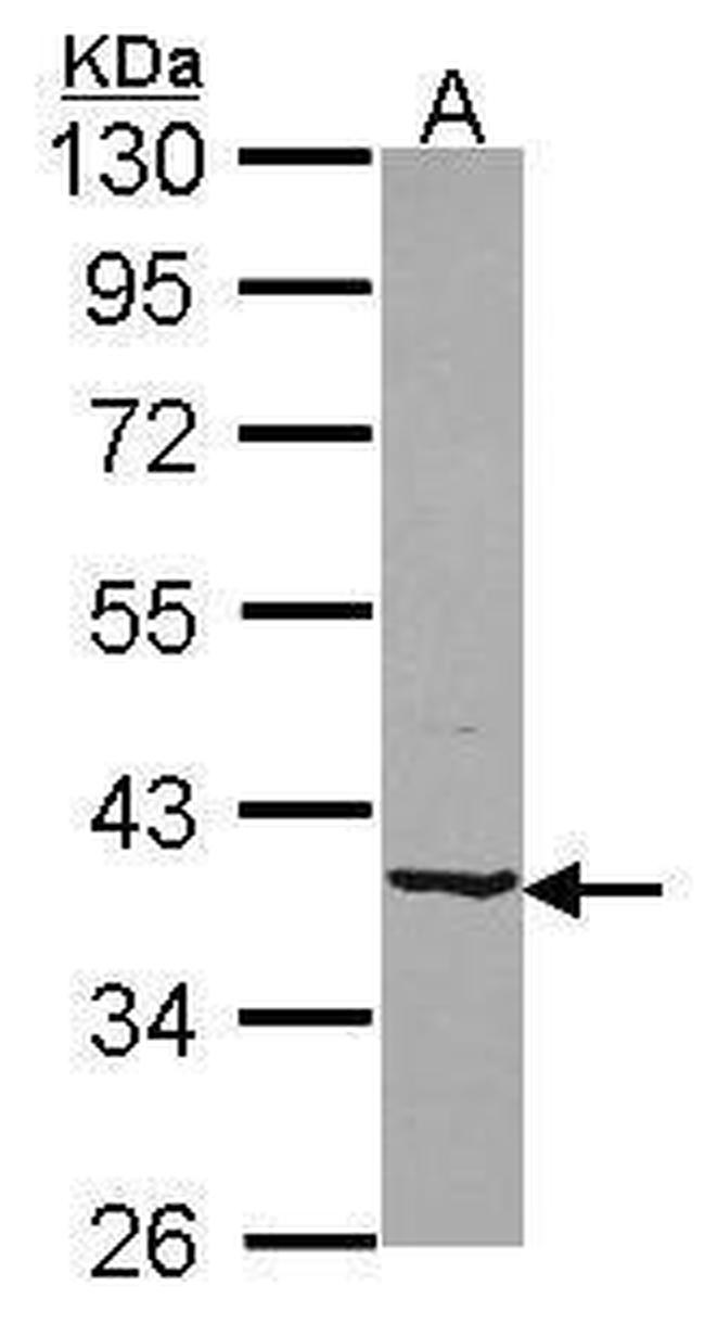 B4GALT4 Antibody in Western Blot (WB)