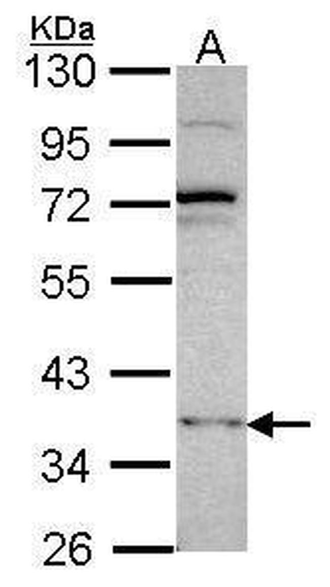 DNMT3L Antibody in Western Blot (WB)