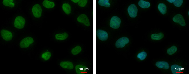 CREST Antibody in Immunocytochemistry (ICC/IF)