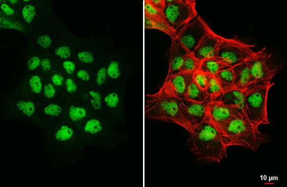 CREST Antibody in Immunocytochemistry (ICC/IF)