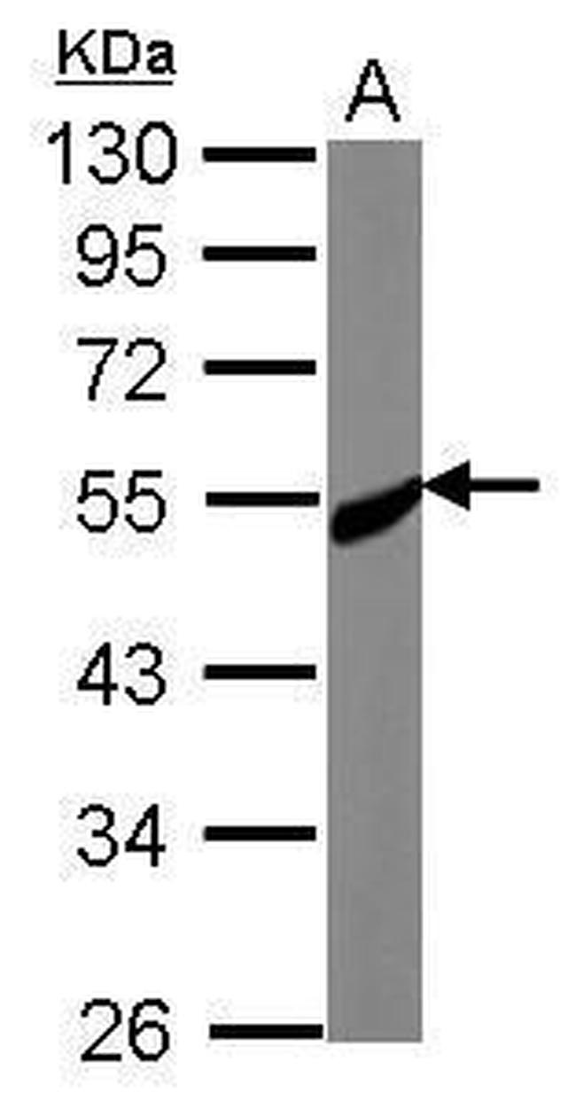 CREST Antibody in Western Blot (WB)