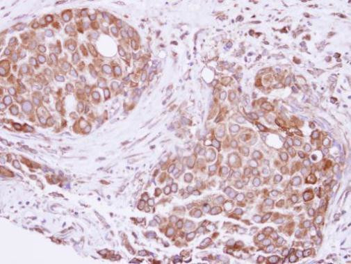 ATE1 Antibody in Immunohistochemistry (Paraffin) (IHC (P))