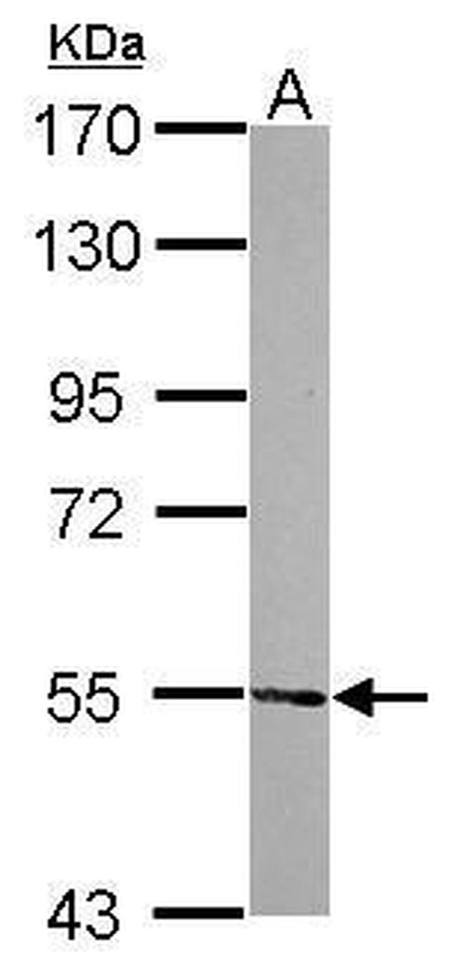 ATE1 Antibody in Western Blot (WB)