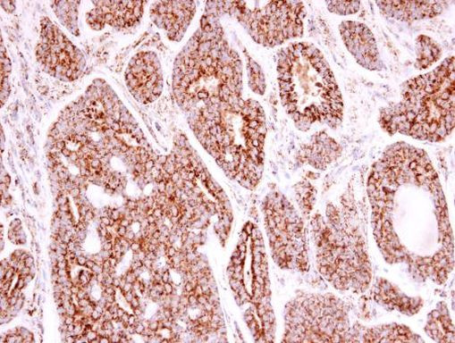 SOD2 Antibody in Immunohistochemistry (Paraffin) (IHC (P))