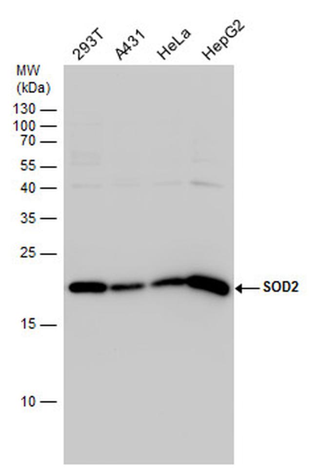 SOD2 Antibody in Western Blot (WB)