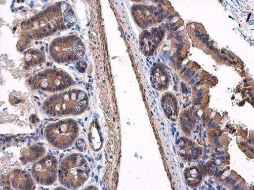 VPS36 Antibody in Immunohistochemistry (Paraffin) (IHC (P))