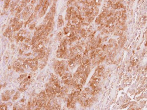 VPS36 Antibody in Immunohistochemistry (Paraffin) (IHC (P))