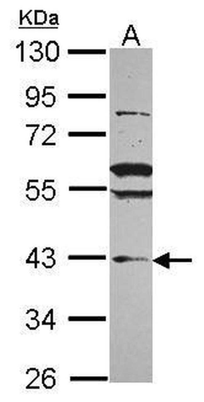 VPS36 Antibody in Western Blot (WB)