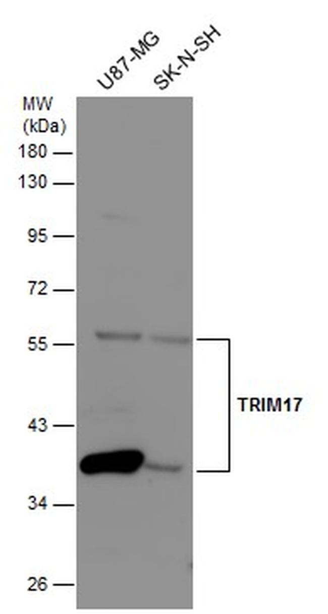 TRIM17 Antibody in Western Blot (WB)