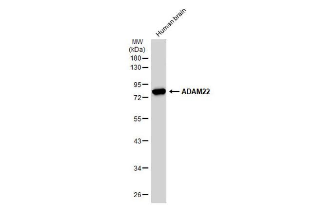 ADAM22 Antibody in Western Blot (WB)