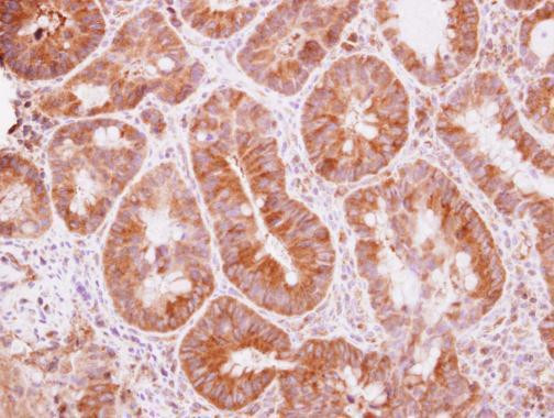 TRIM25 Antibody in Immunohistochemistry (Paraffin) (IHC (P))