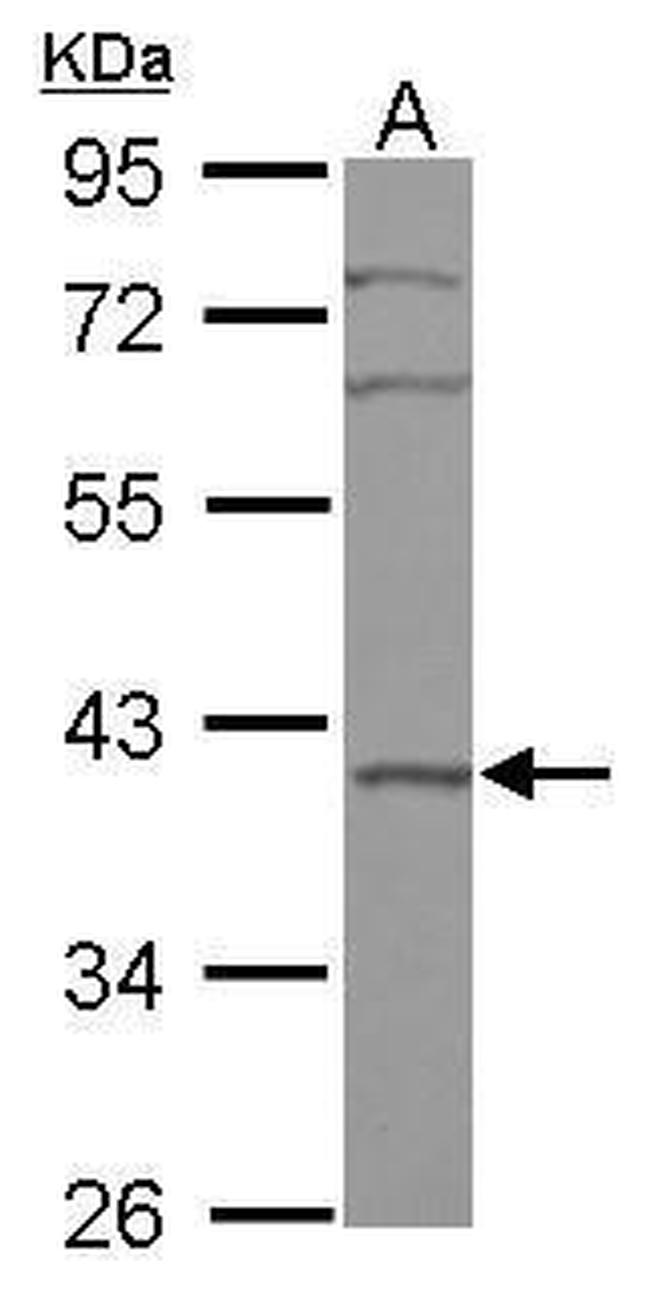 BXDC2 Antibody in Western Blot (WB)