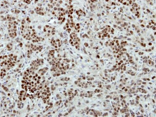 Macro H2A.2 Antibody in Immunohistochemistry (Paraffin) (IHC (P))