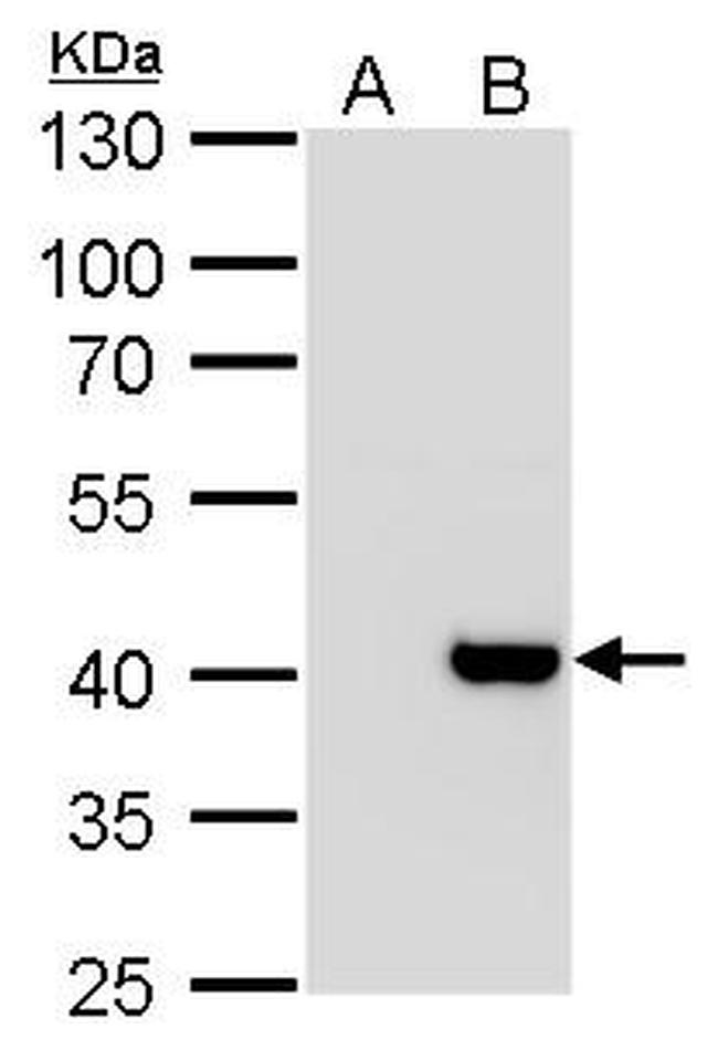 Macro H2A.2 Antibody in Western Blot (WB)