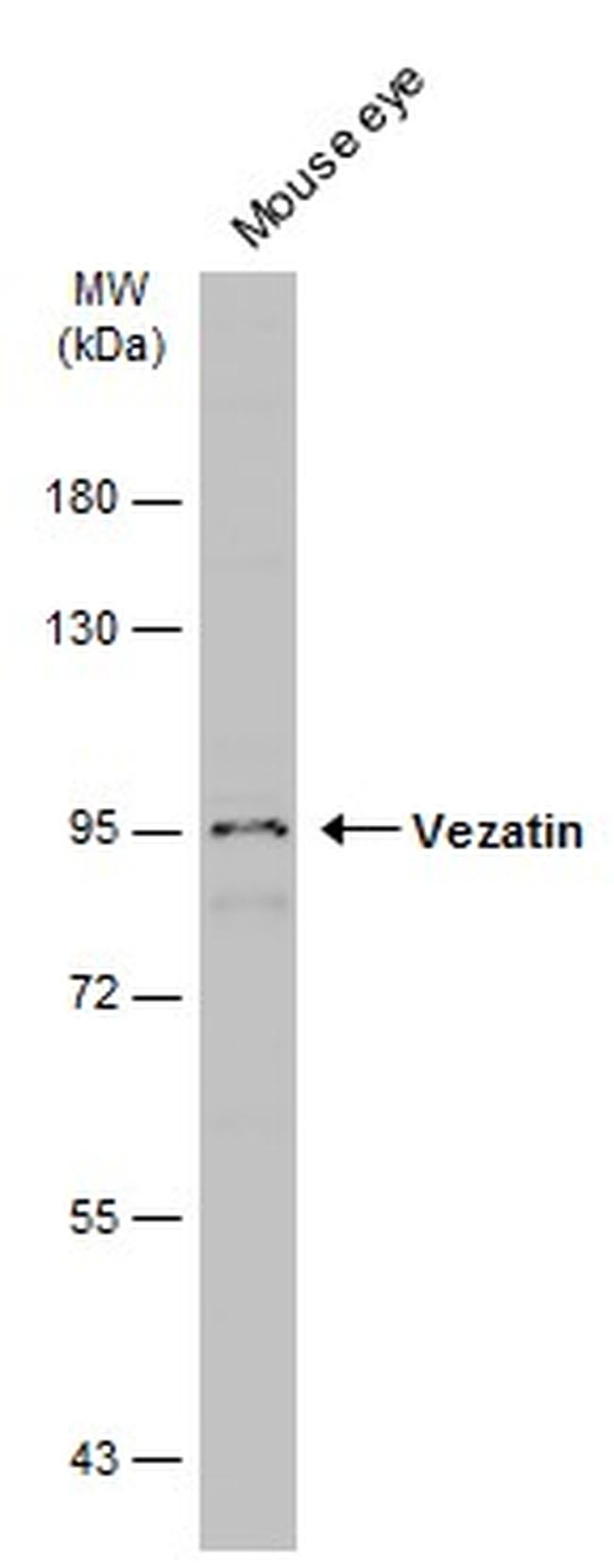 Vezatin Antibody in Western Blot (WB)