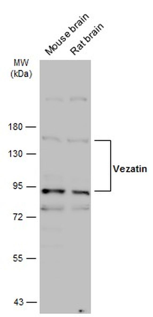Vezatin Antibody in Western Blot (WB)