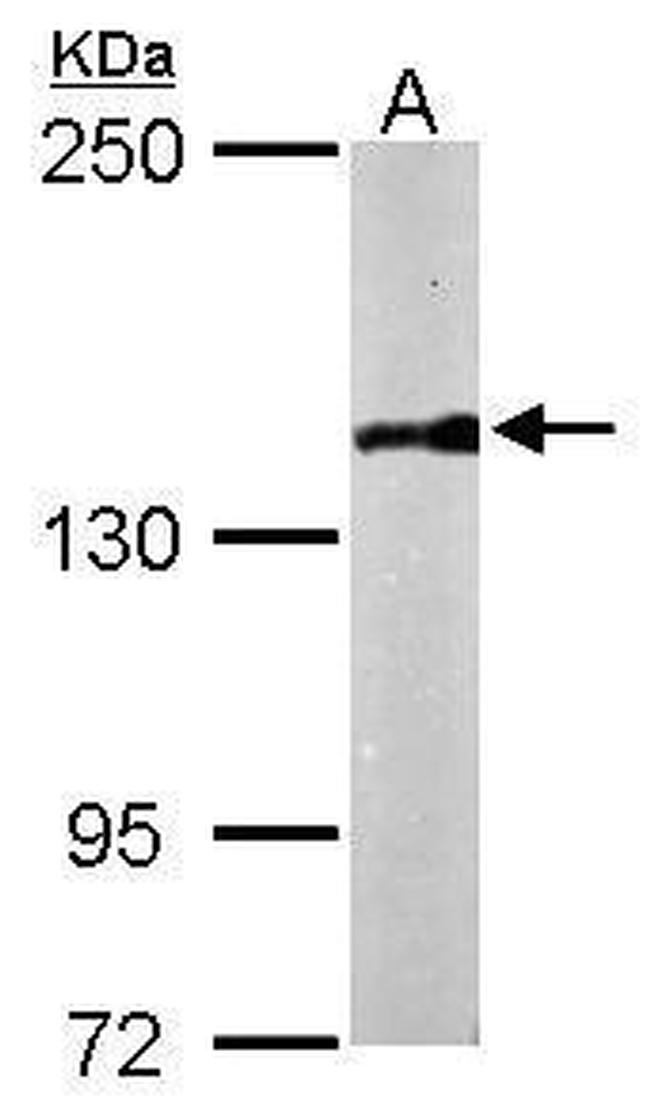 PDS5B Antibody in Western Blot (WB)