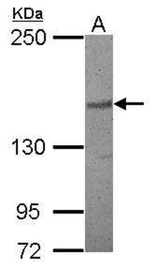 PDS5B Antibody in Western Blot (WB)