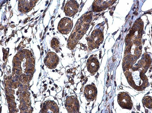 TARS Antibody in Immunohistochemistry (Paraffin) (IHC (P))