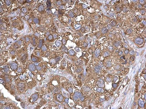 TARS Antibody in Immunohistochemistry (Paraffin) (IHC (P))