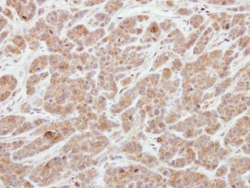 AGAP1 Antibody in Immunohistochemistry (Paraffin) (IHC (P))