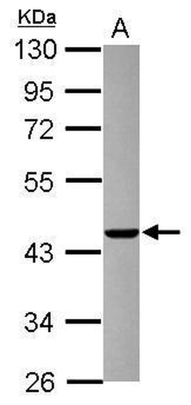 AGAP1 Antibody in Western Blot (WB)