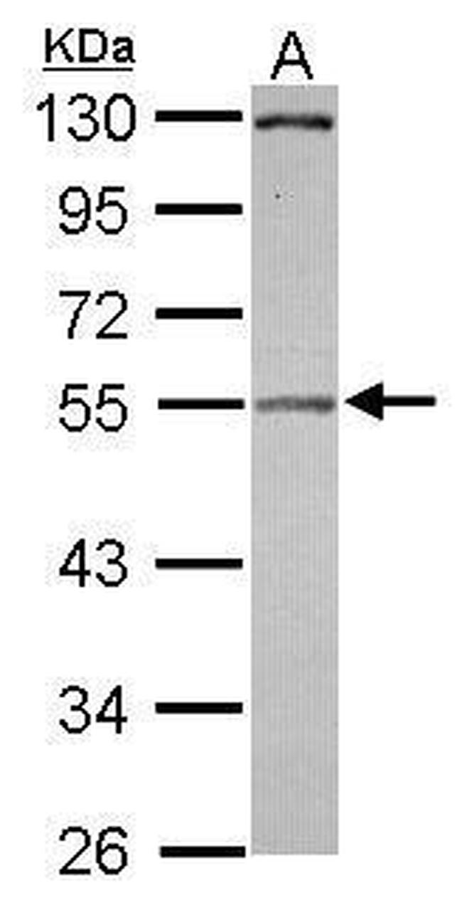 Pellino 2 Antibody in Western Blot (WB)