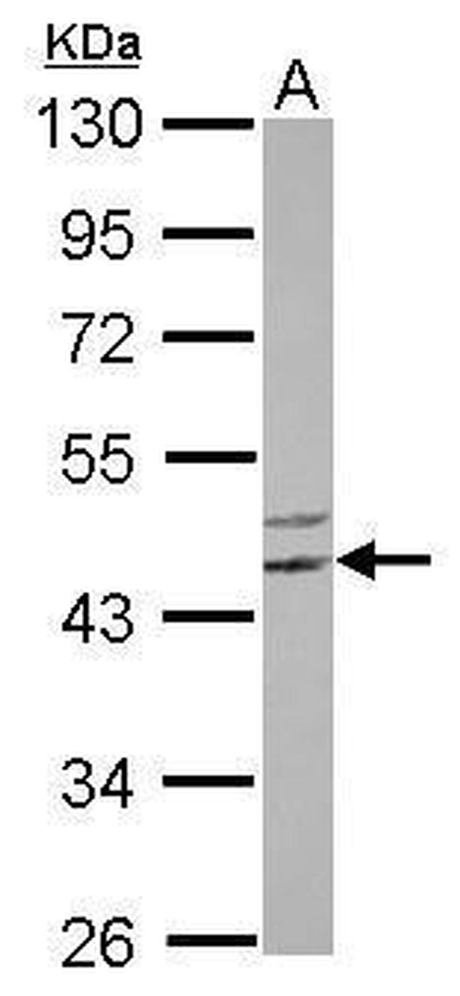 SGK494 Antibody in Western Blot (WB)