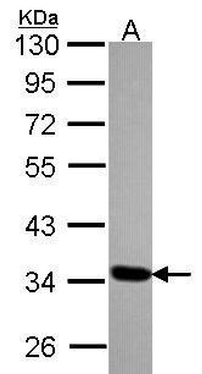 TOMM34 Antibody in Western Blot (WB)