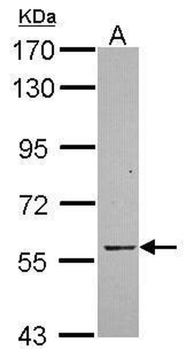 HACL1 Antibody in Western Blot (WB)