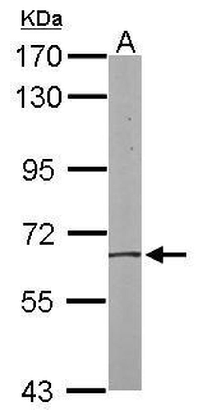 HACL1 Antibody in Western Blot (WB)