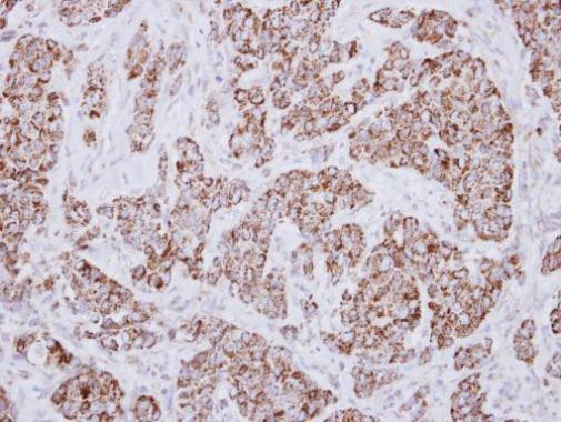 MCCC2 Antibody in Immunohistochemistry (Paraffin) (IHC (P))