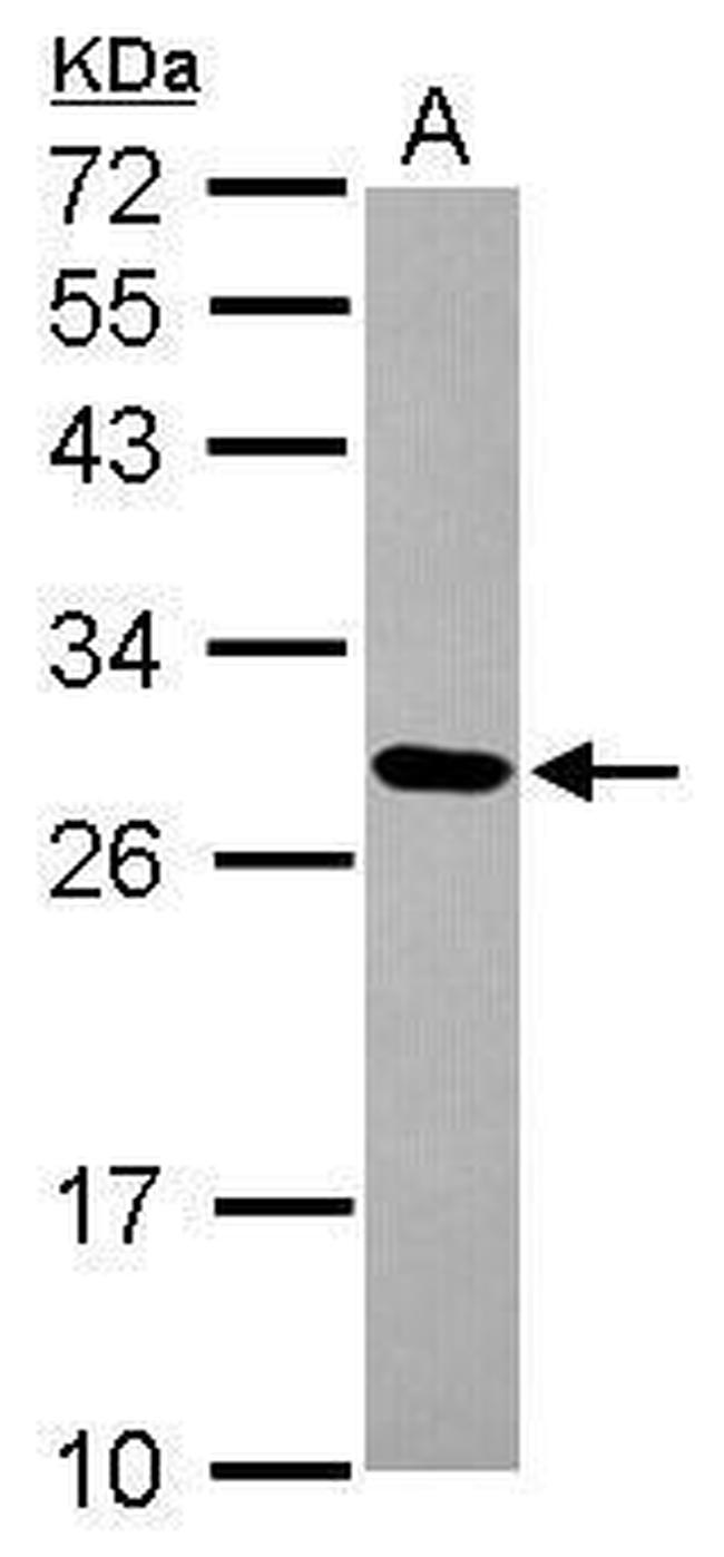 MRPL9 Antibody in Western Blot (WB)