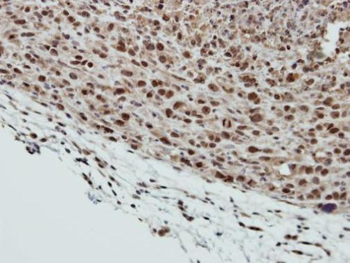 SMC6 Antibody in Immunohistochemistry (Paraffin) (IHC (P))