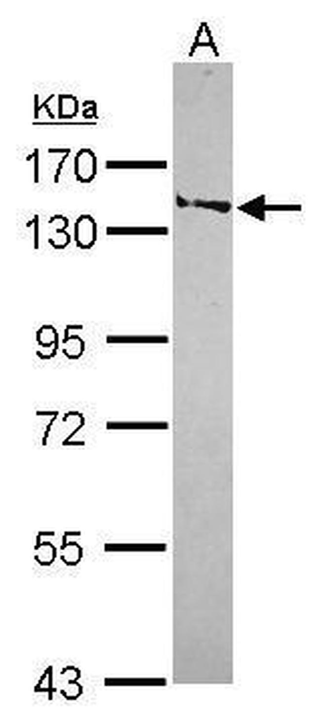 SMC6 Antibody in Western Blot (WB)