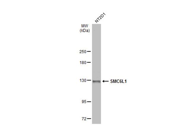 SMC6 Antibody in Western Blot (WB)