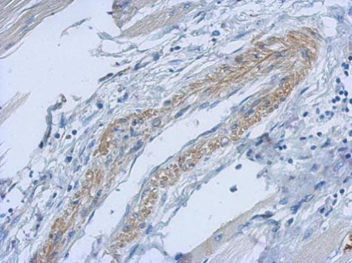 PARD6B Antibody in Immunohistochemistry (Paraffin) (IHC (P))