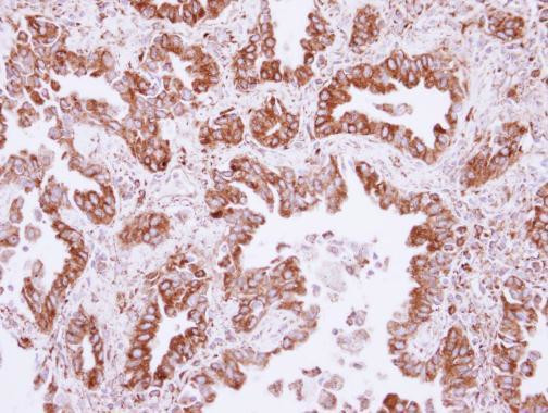 CML66 Antibody in Immunohistochemistry (Paraffin) (IHC (P))