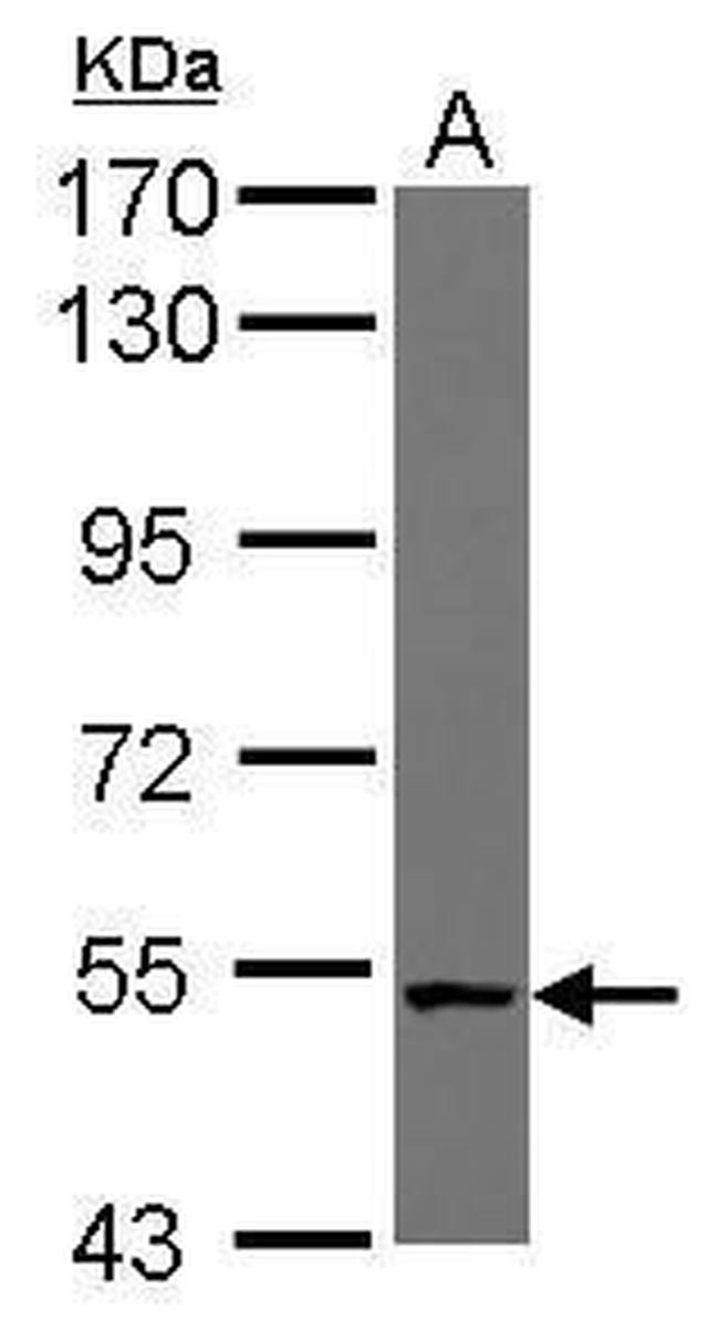 CML66 Antibody in Western Blot (WB)