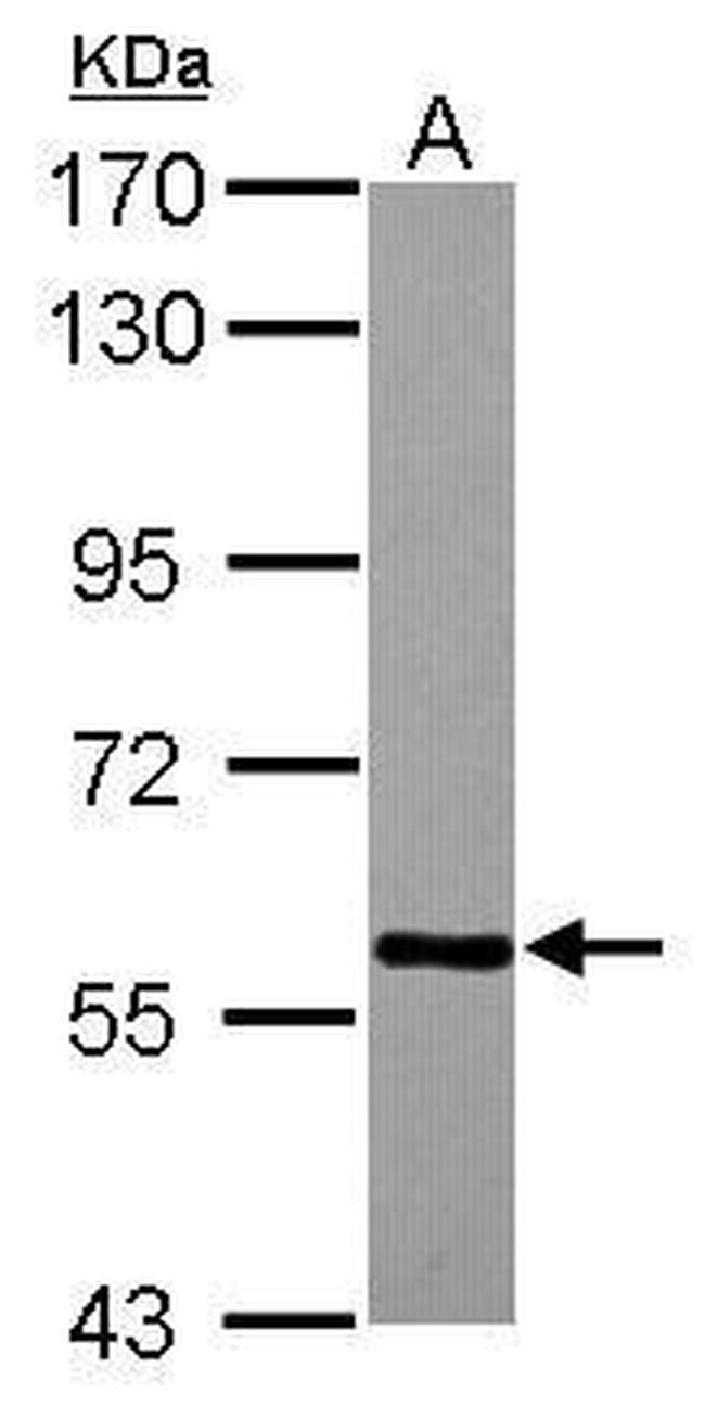 TBLR1 Antibody in Western Blot (WB)