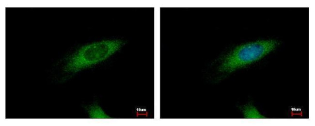 HIP1R Antibody in Immunocytochemistry (ICC/IF)