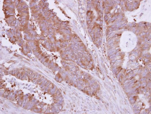 HIP1R Antibody in Immunohistochemistry (Paraffin) (IHC (P))