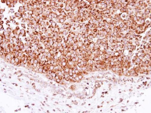 DECR1 Antibody in Immunohistochemistry (Paraffin) (IHC (P))