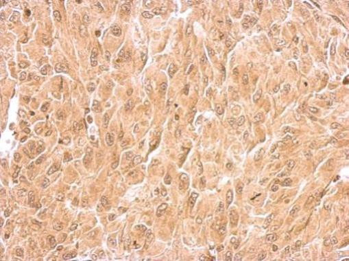 RIN2 Antibody in Immunohistochemistry (Paraffin) (IHC (P))